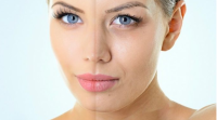 Лазерное омоложение кожи - эффективный способ борьбы с возрастными изменениями